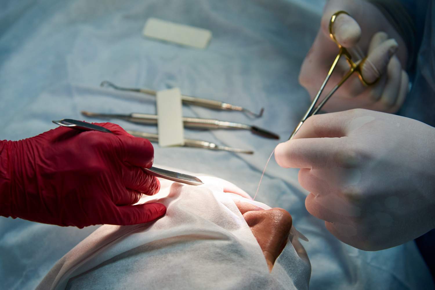 ¿Qué es la cirugía bucal y cuándo es necesaria?