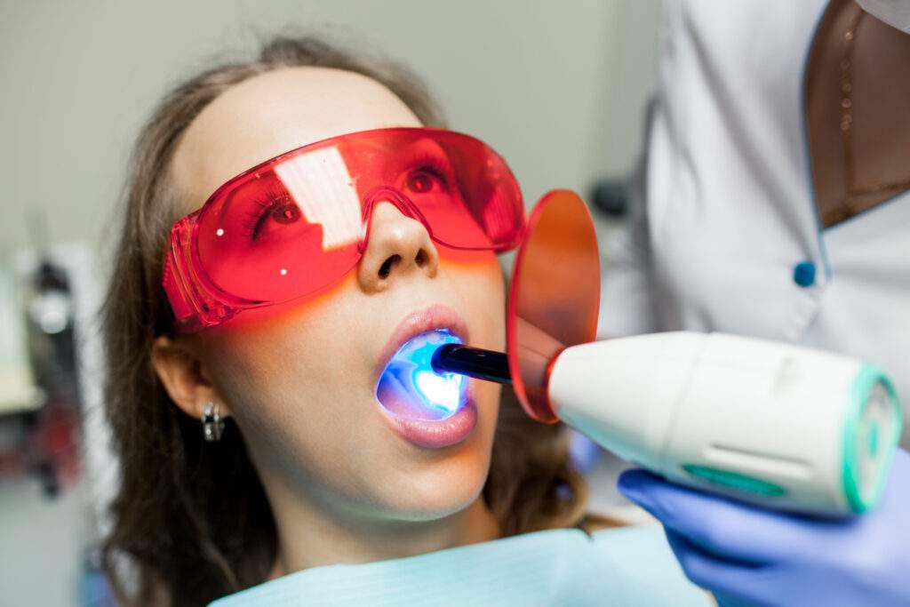 Blanqueamiento dental profesional: Recupera el brillo natural de tu sonrisa