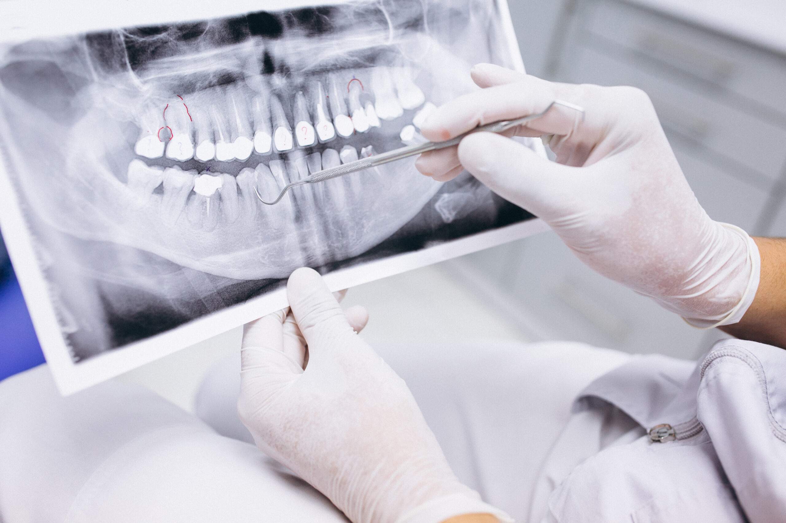 Tratamiento de implantología dental en Artidental